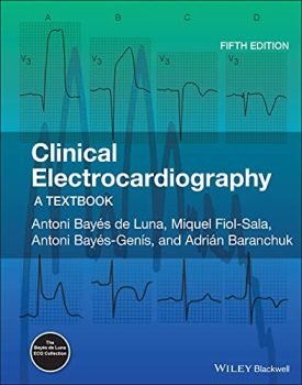 Clinical Electrocardiography: A Textbook