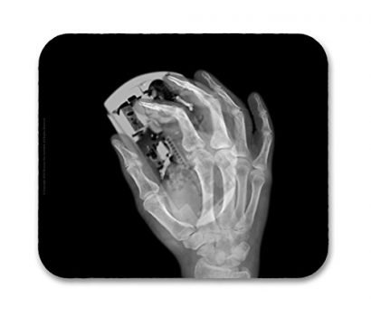 X-ray Image of Computer Mouse and Hand - Unique Mouse Pad - Neurons Not Included