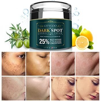 CITYGOO Dark Spot Remover for Face and Body, Dark Spot Corrector Cream, Natural Ingredient,Enriching Skin Care For All Skin Tones - Melasma, Freckle, Sun Spot Remover & Blemish Reducer-1.7 FL OZ